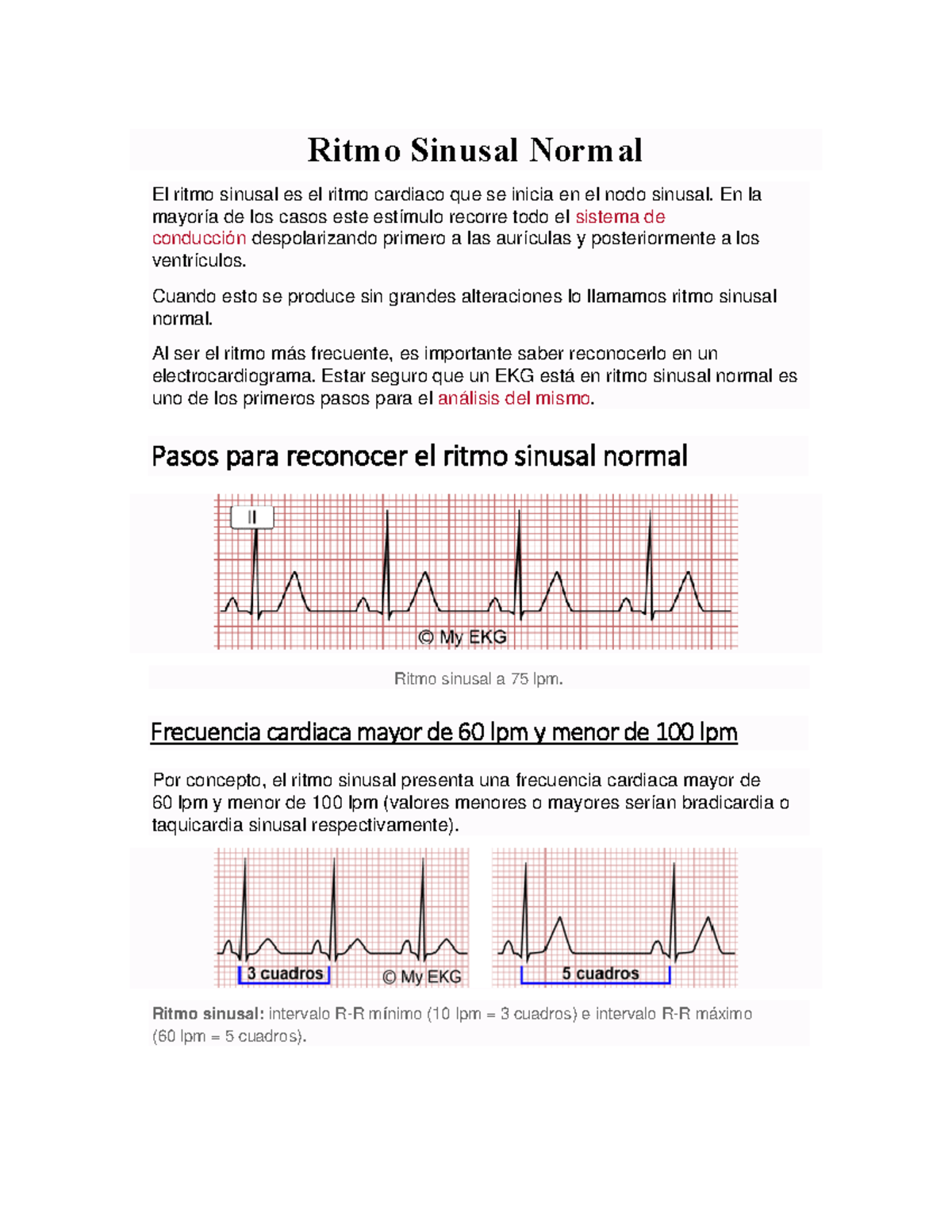 Ritmo Sinusal Normal - En la mayoría de los casos este estímulo recorre ...