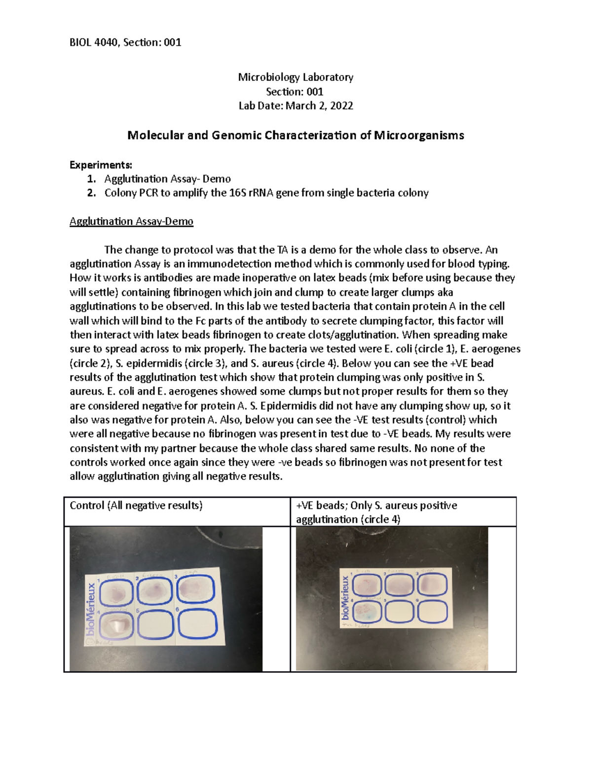 Lab 7 BIOL 4040 - BIOL 4040, Section: 001 Microbiology Laboratory ...