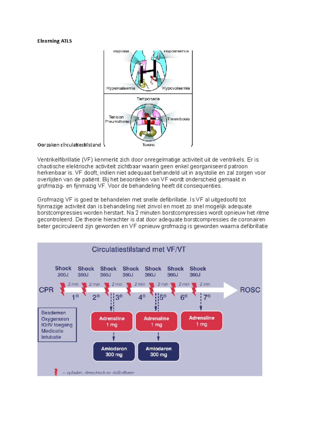 Elearning ATLS! Elearning ATLS Oorzaken circulatiestilstand