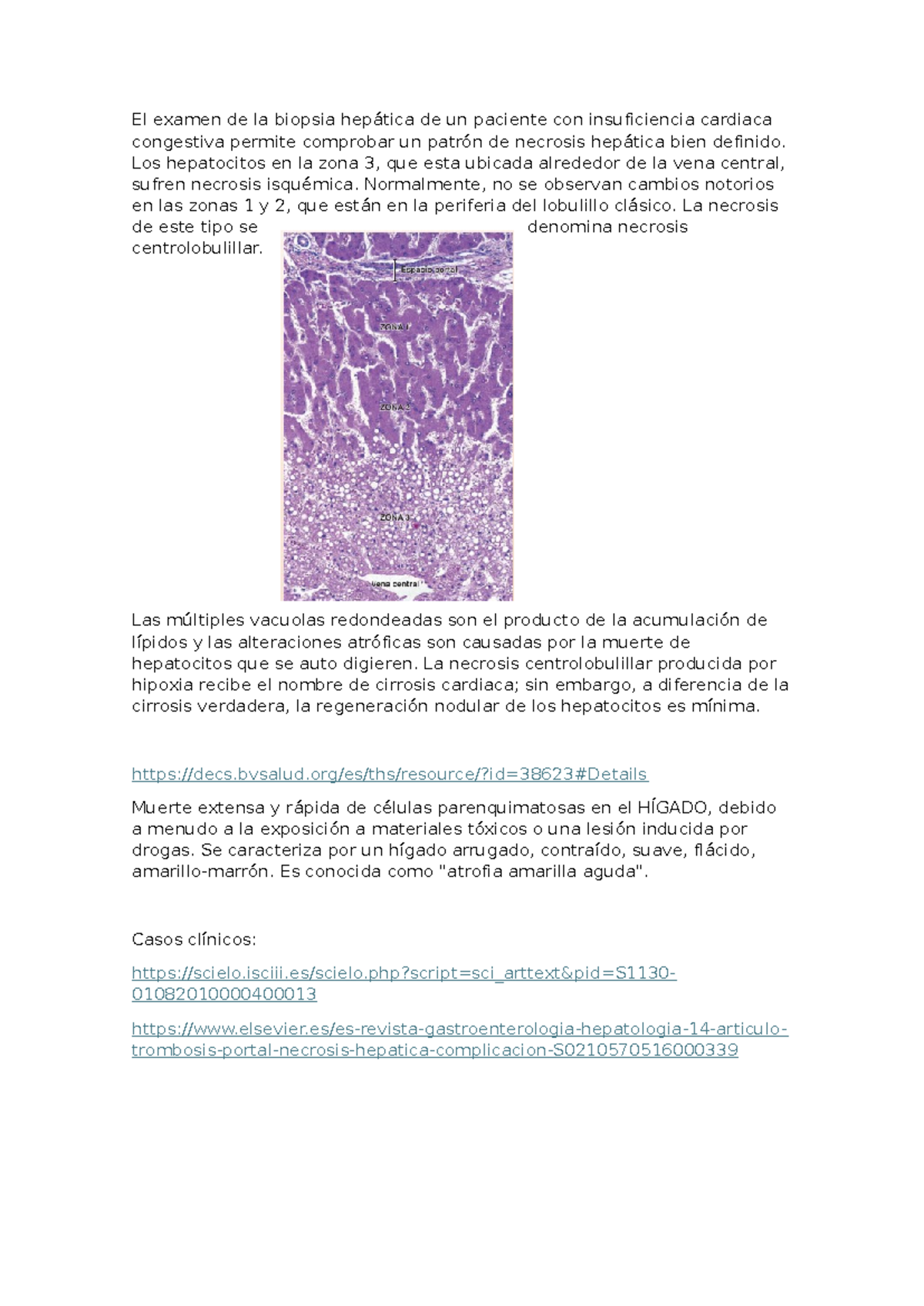 Necrosis hepatica - El examen de la biopsia hepática de un paciente con ...