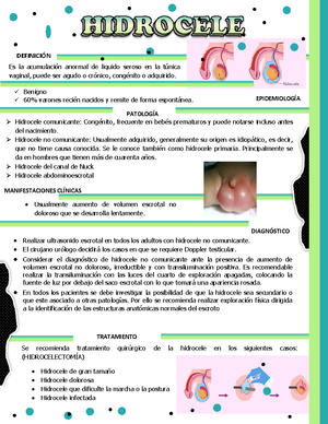 tratamiento de hidrocele