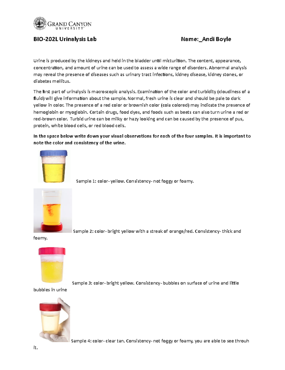 Lab Activity Urinalysis 12 2 21 12 31 Am Laboratory Simulation