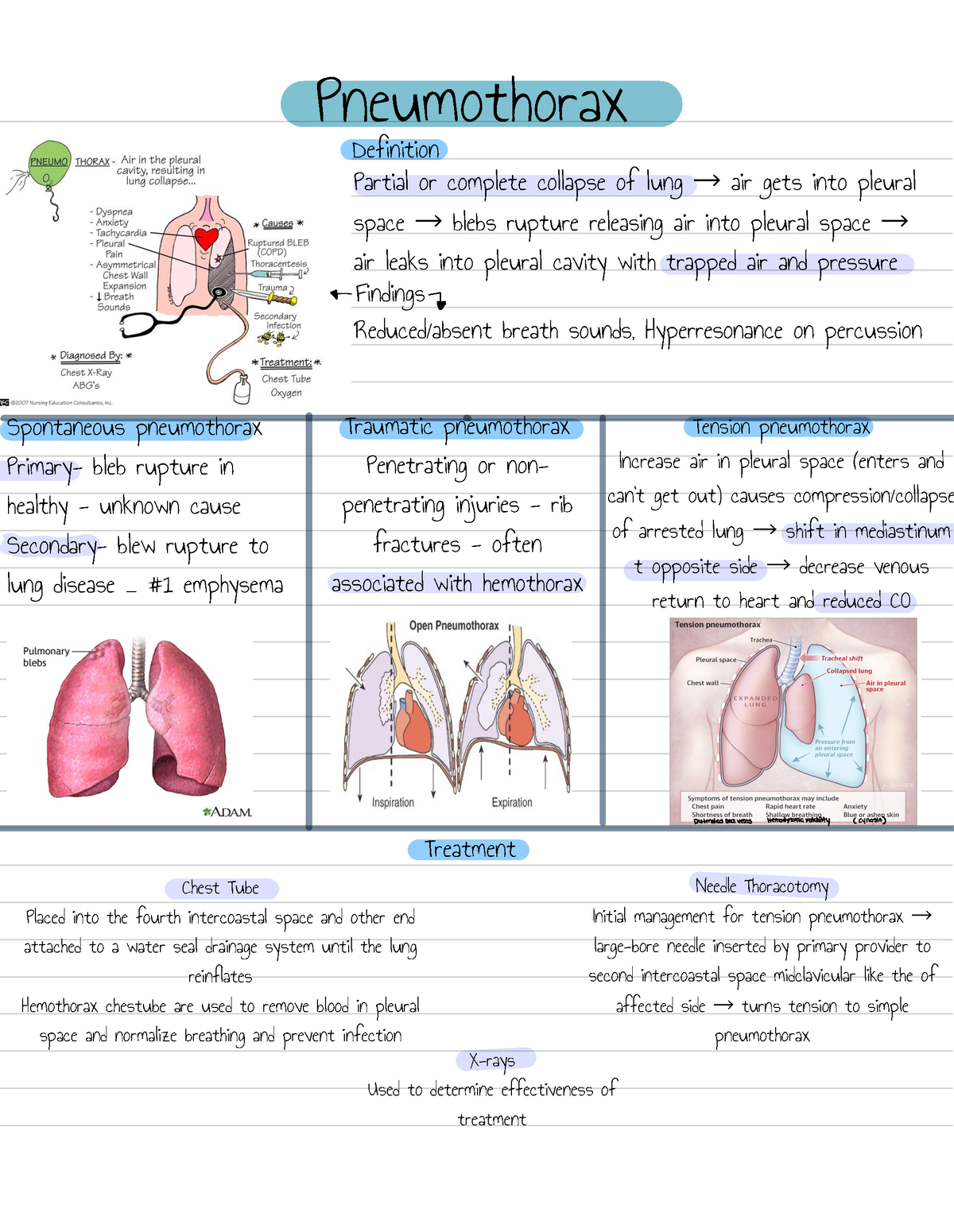 Respiratory -2 - Pneumothorax Definition Partial or complete collapse ...