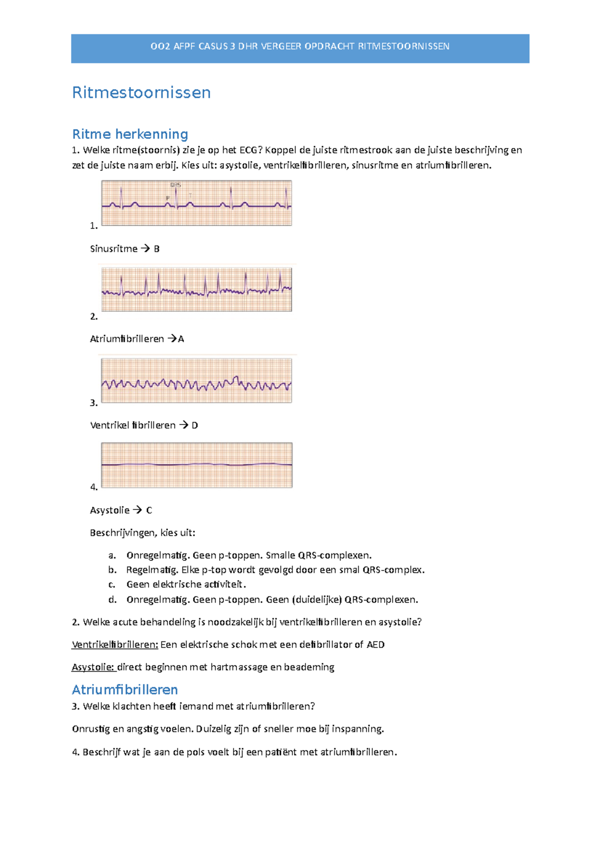 AFPF ritme stoornissen - Ritmestoornissen Ritme herkenning Welke ritme ...