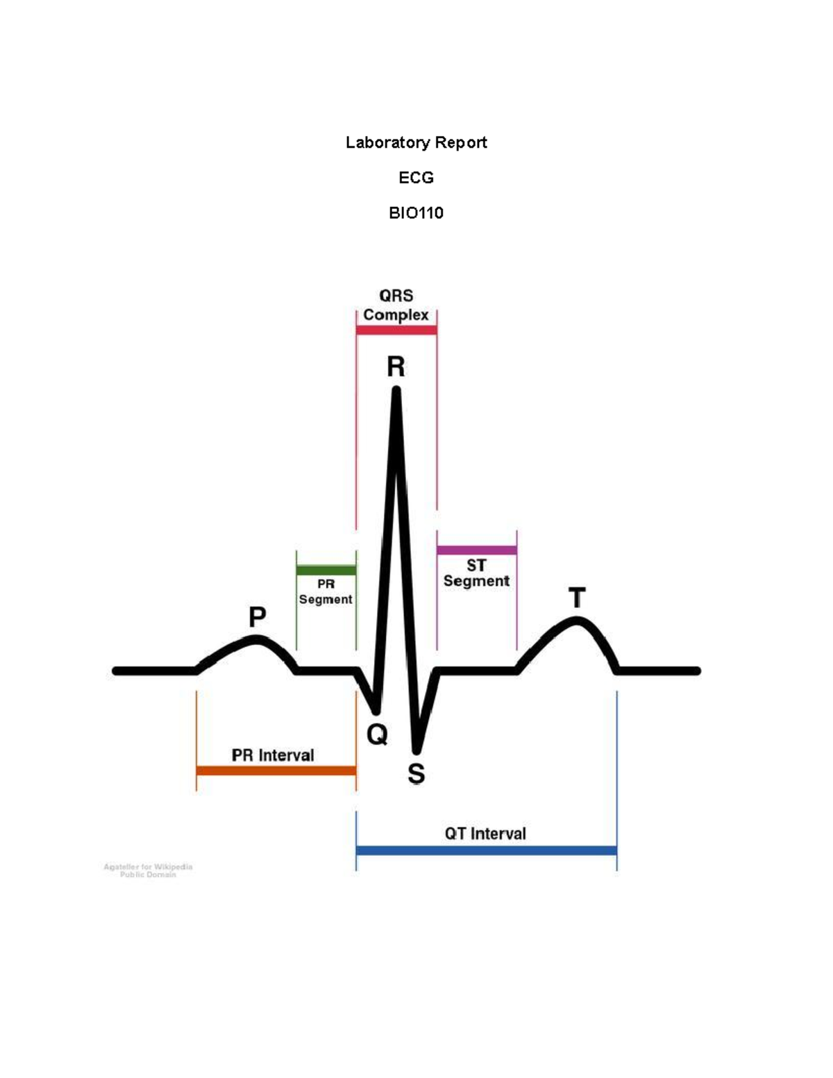 Lab Report ECG BIO110 Spring 2018 - Laboratory Report ECG BIO Define ...