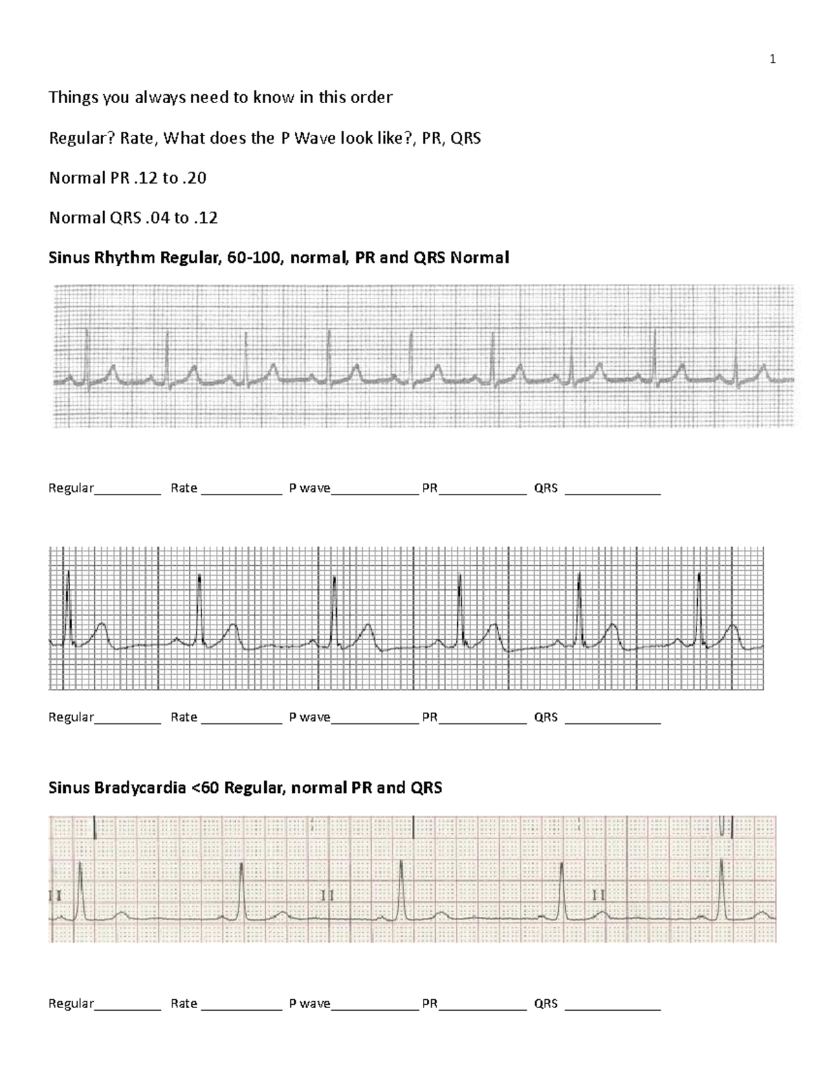 EKG worksheet and practice-1 - Things you always need to know in this ...