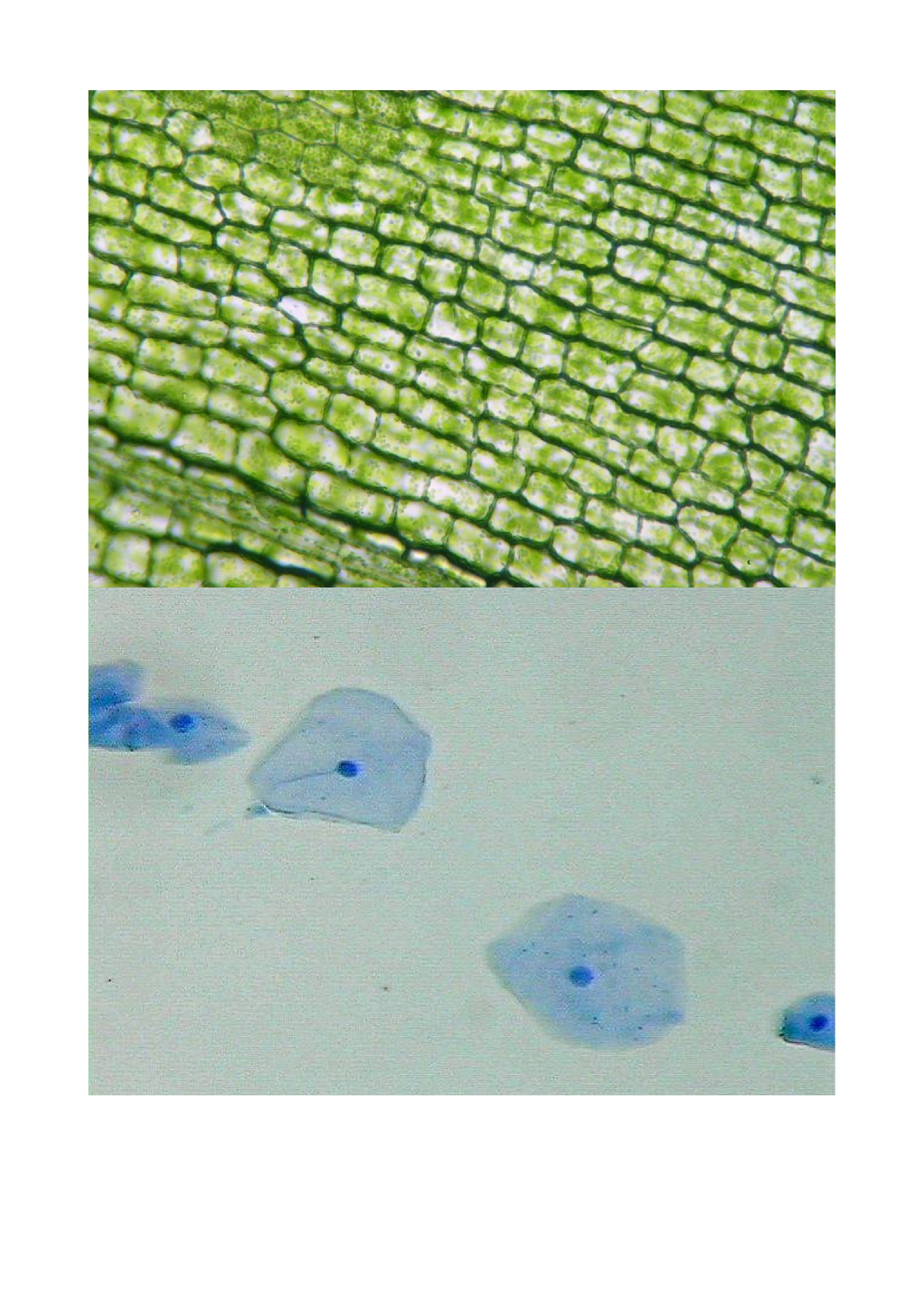 Mikroskopering af plante- dyreceller - kani, og caro - Mikroskoper ing af - Studocu