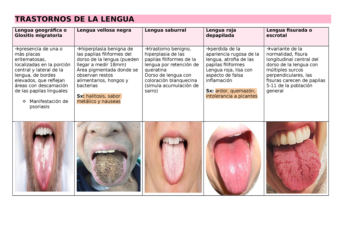 Trastornos De La Lengua Trastornos De La Lengua Lengua Geográfica O Glositis Migratoria Lengua 5358