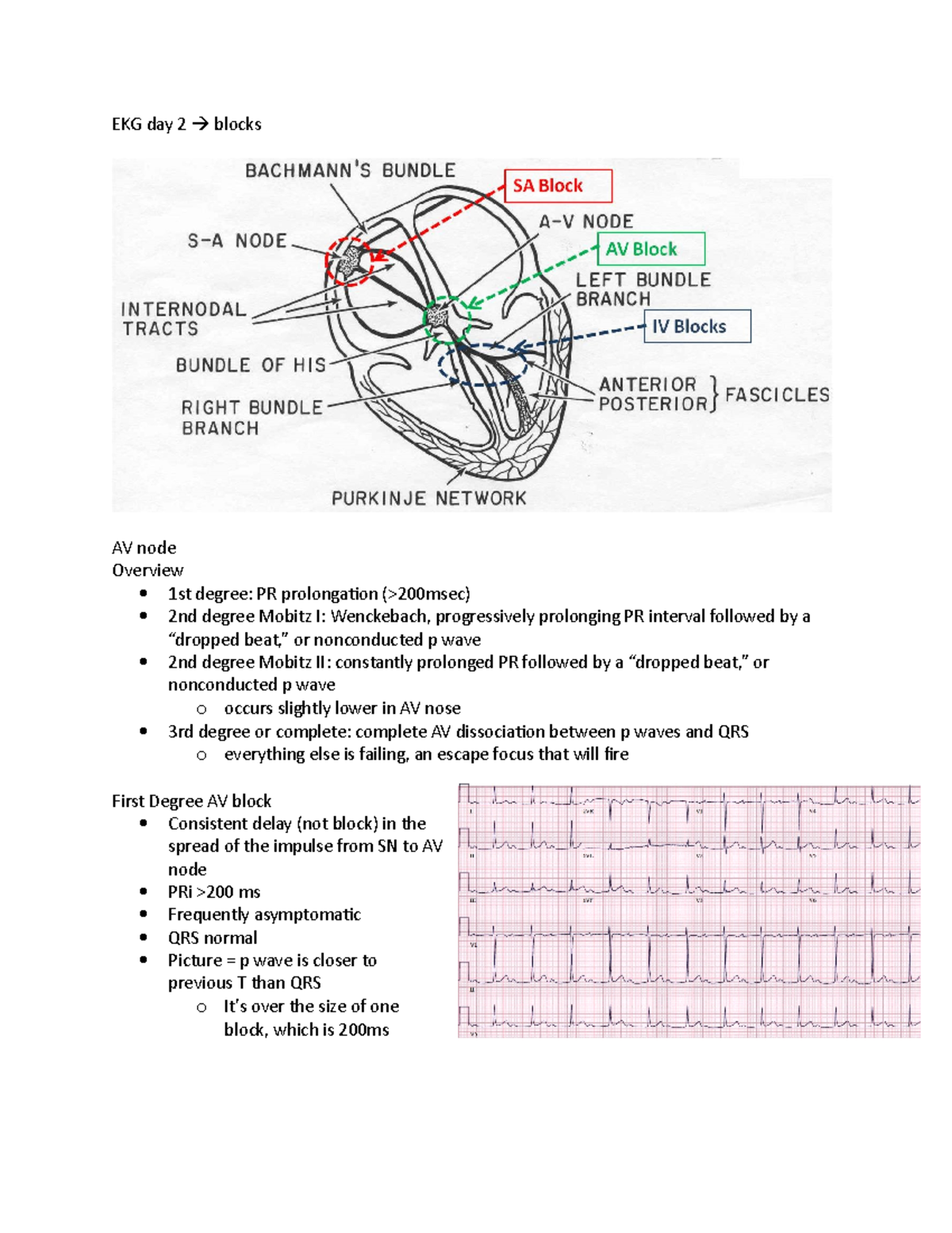 EKG day 2 - EKG lecture notes - EKG day 2 blocks AV node Overview 1st ...