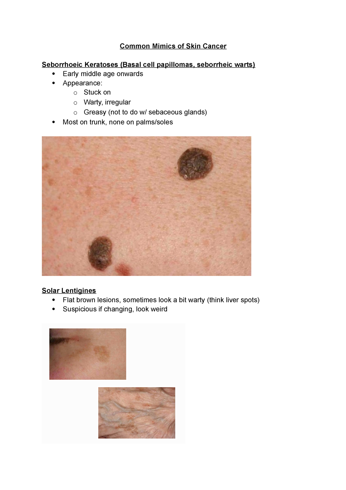 5 Common Mimics Of Skin Cancer Studocu