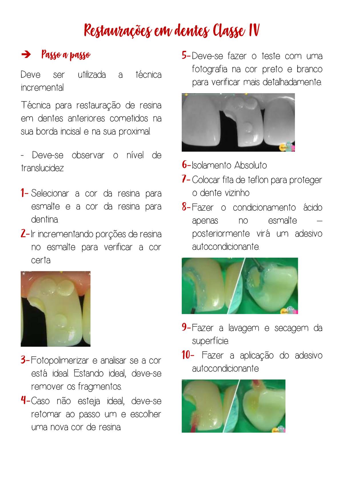 Restaurações em dentes Classe IV Restaurações em dentes Classe IV Passo a passo Deve ser Studocu