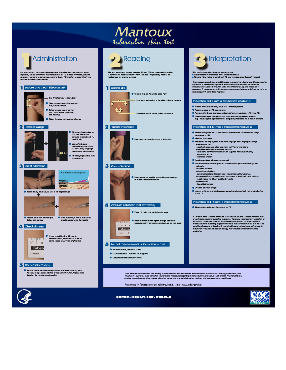 Mantoux Wallchart Matnoux Mantoux Tuberculin Skin Test 1 2 3