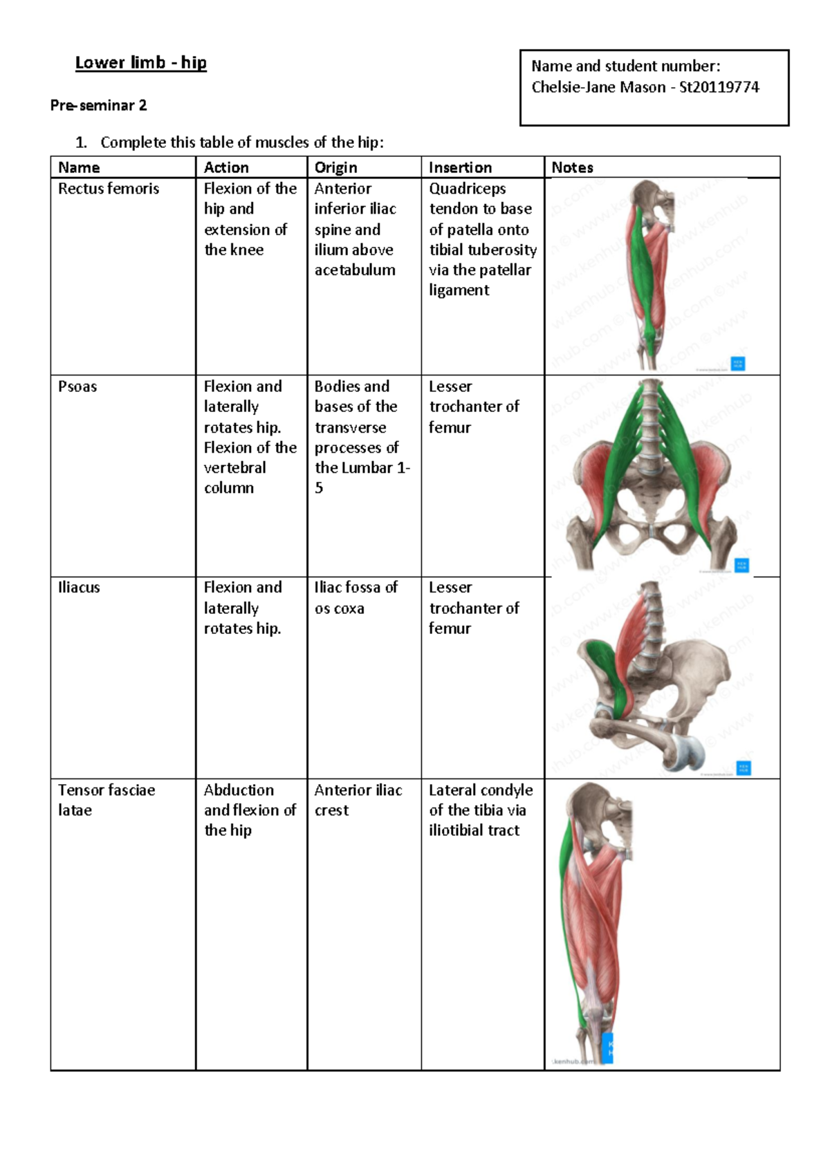 Hip2 - Anatomy of the hip - Warning: TT: undefined function: 32 Lower ...