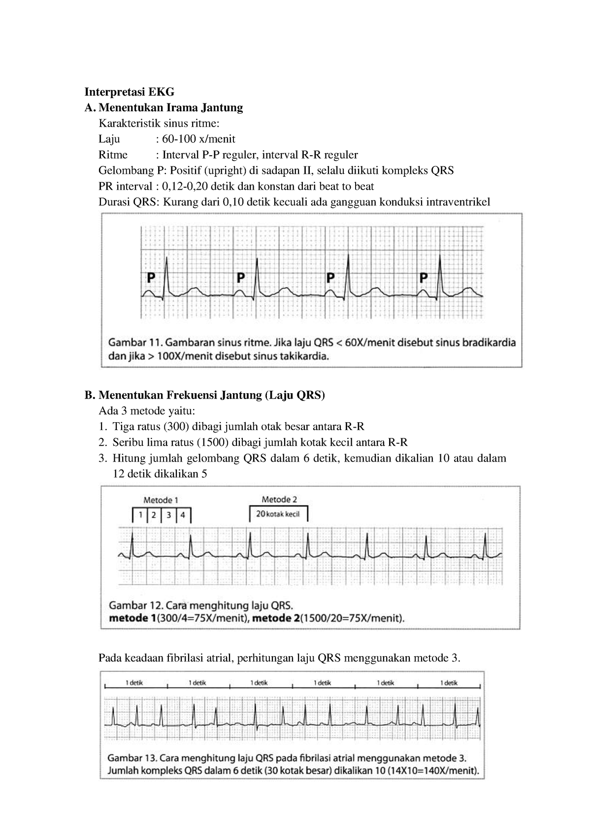 interpretasi-ekg-menentukan-irama-jantung-karakteristik-sinus-ritme