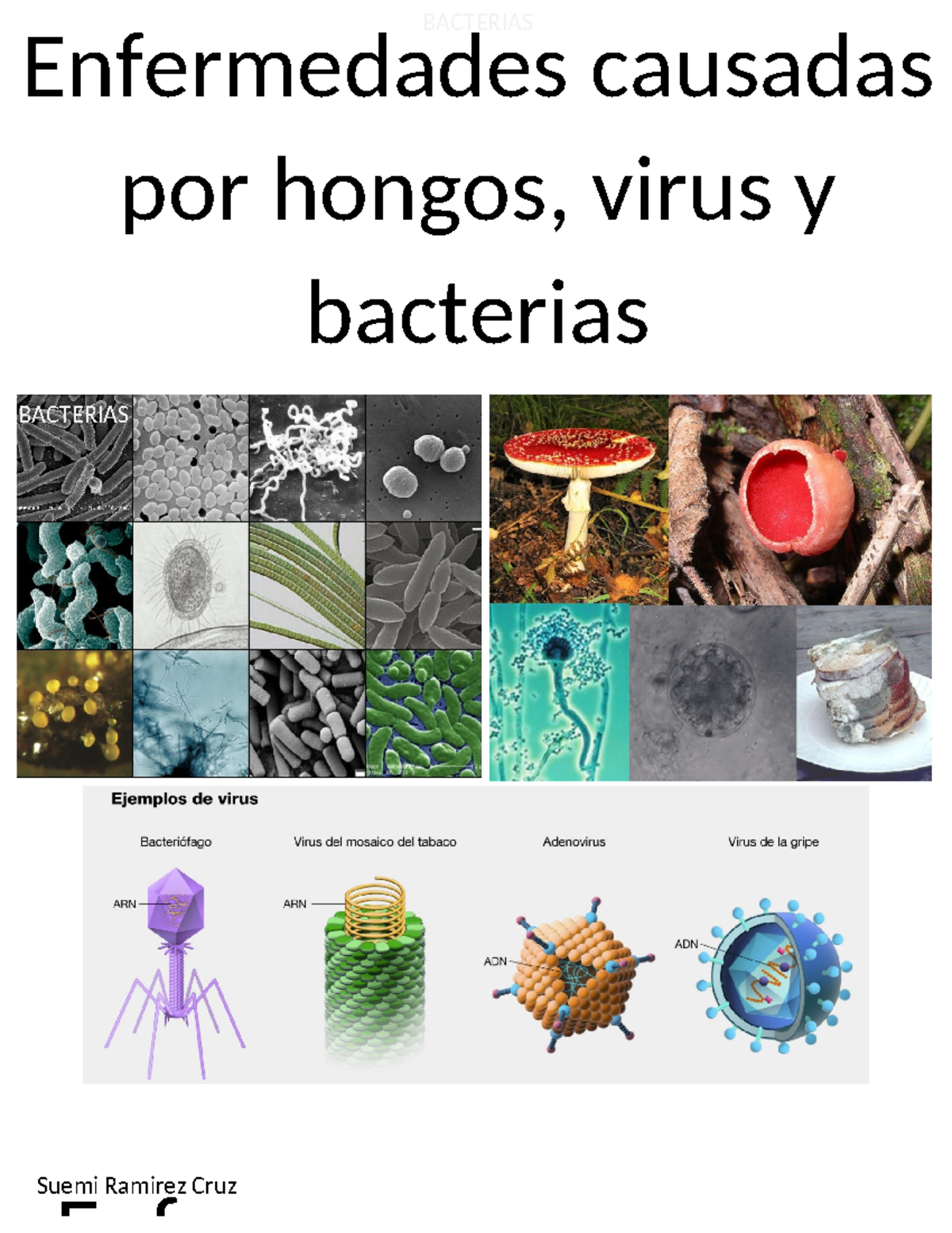 enfermedades causadas por hongos