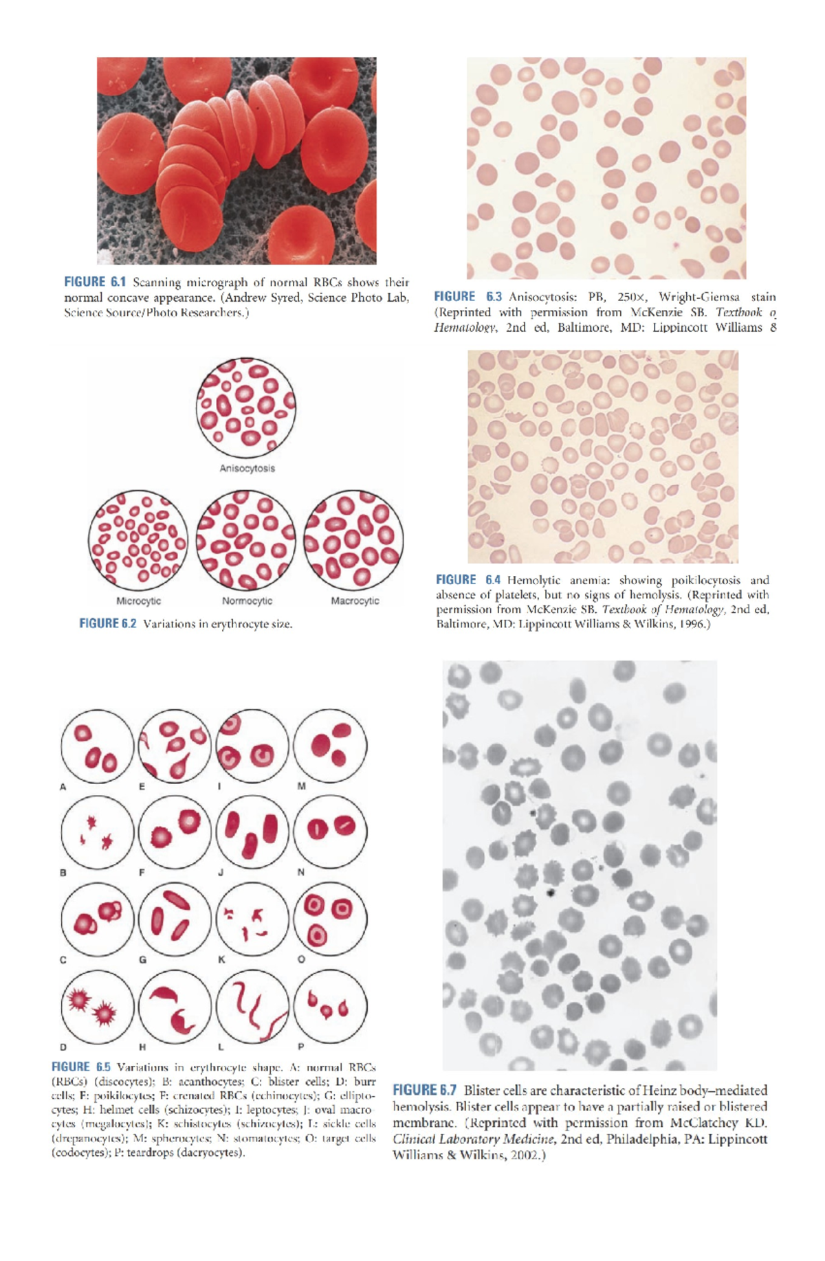 Turgeon'S Pictures of RBCs - HEMA - Hematology 1 - Studocu