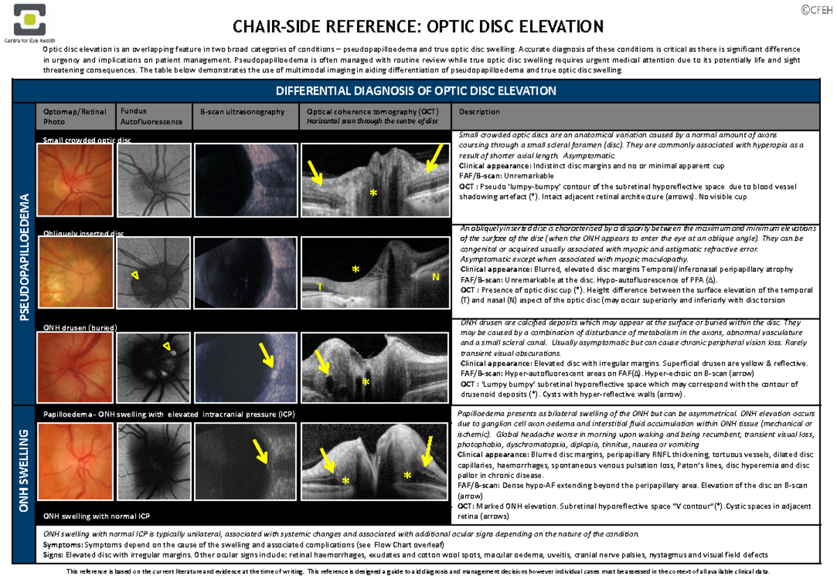 5. Optic DISC Elevation for web DIFFERENTIAL DIAGNOSIS OF OPTICDISC
