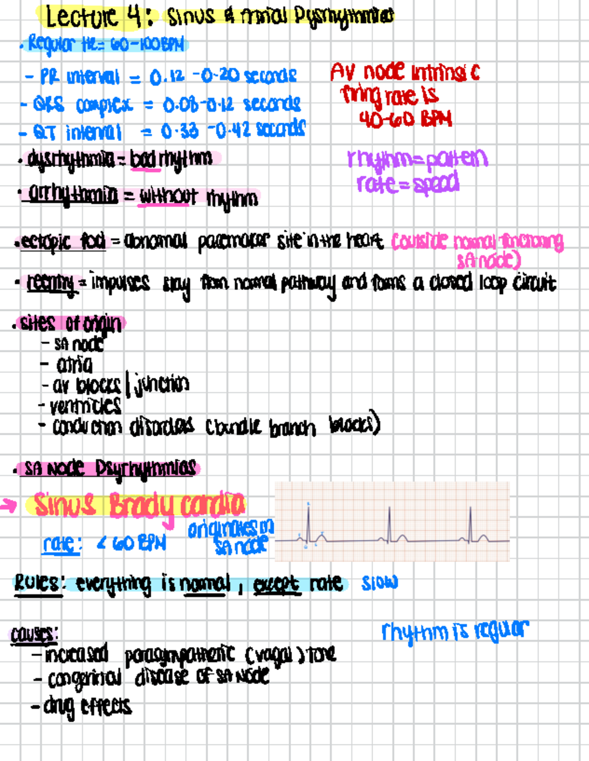 Lec 4-6 notes - Lecture 4 : Sinus & Atrial Pyrhythmias · Regular R= 60 ...