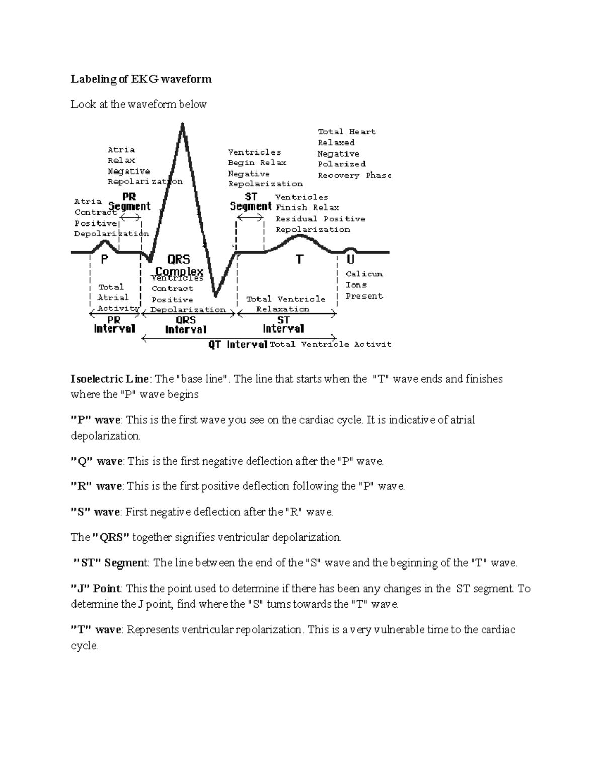 Labeling Of EKG Waveform - The Line That Starts When The "T" Wave Ends ...