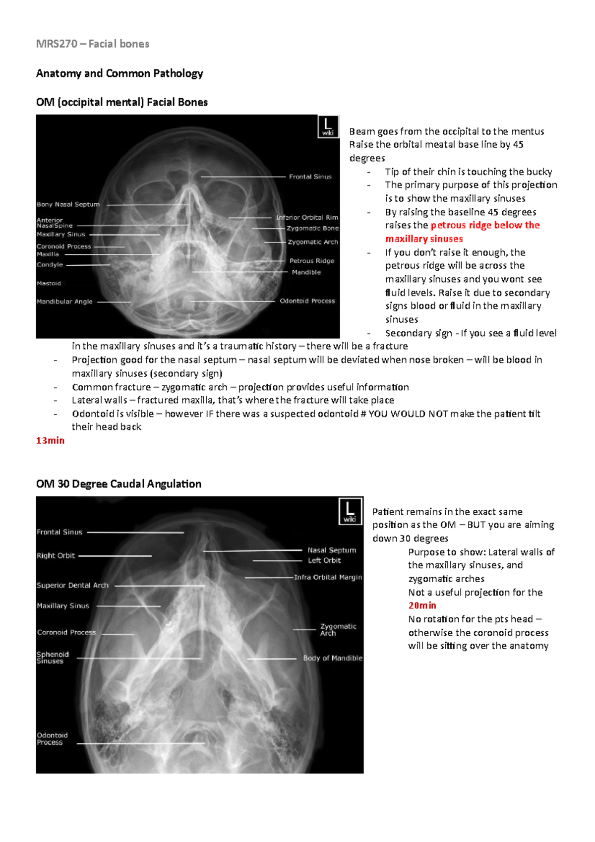 MRS270 Facial bones Lecture notes 11 MRS270 Facial bones Anatomy