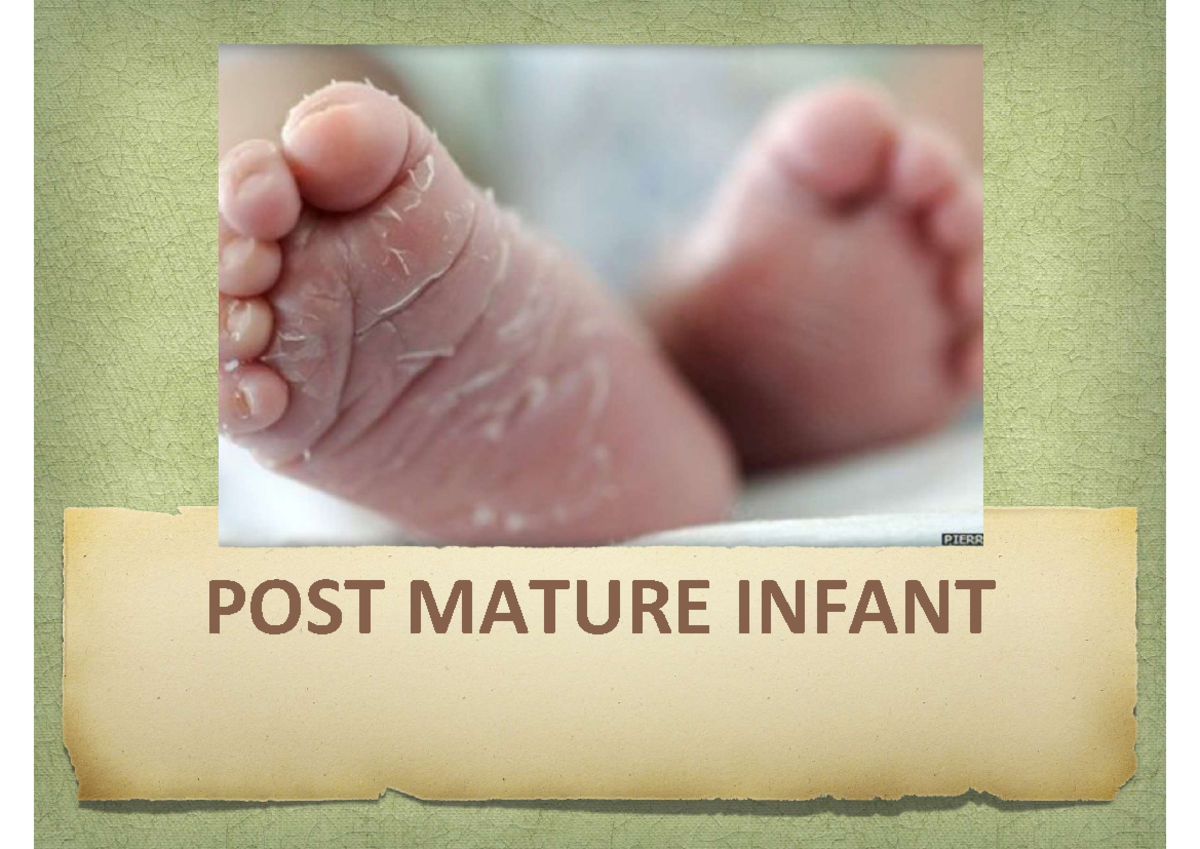 POST Maturity pedia - POST MATURE INFANT POSTMATURITY An infant born ...