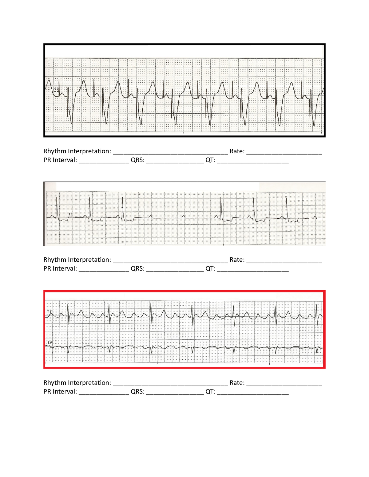 Practice Rhythm Interpretation 2 - PR Interval: ______________ QRS ...