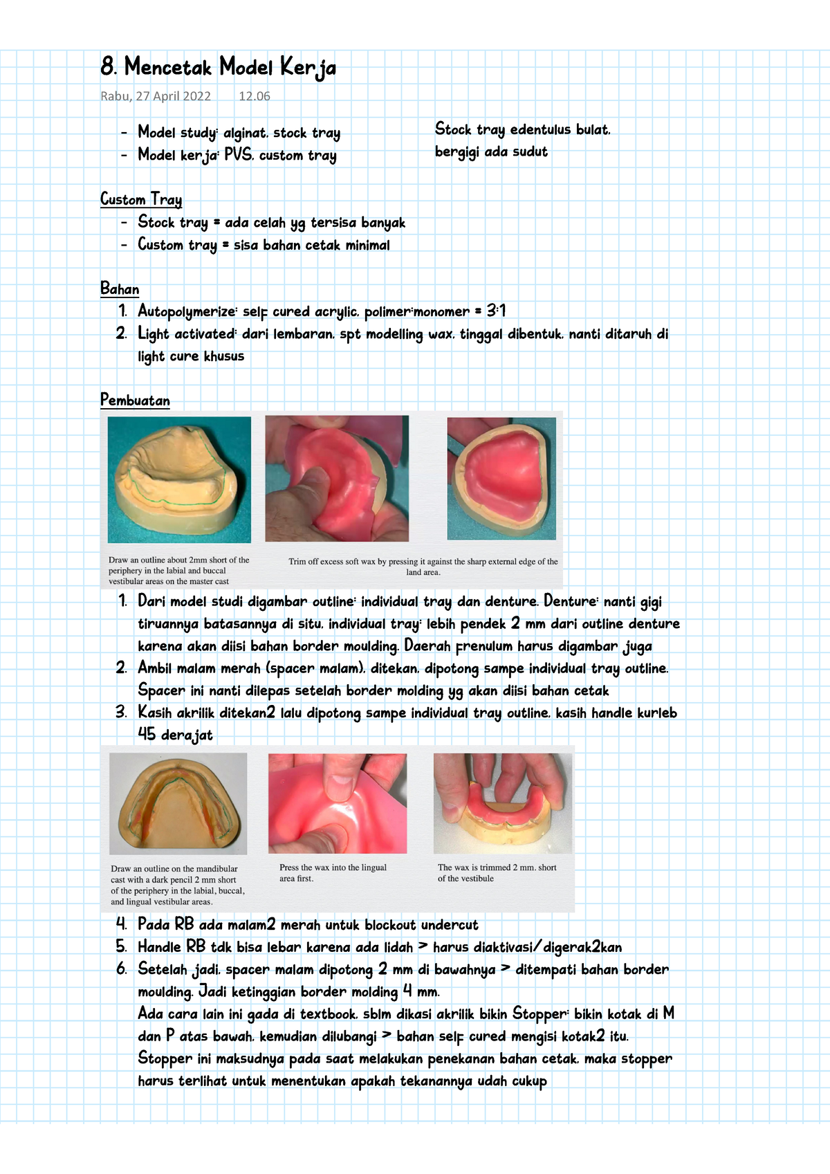 Prostodonsia II - 8. Mencetak Model Kerja - Model Study: Alginat, Stock ...