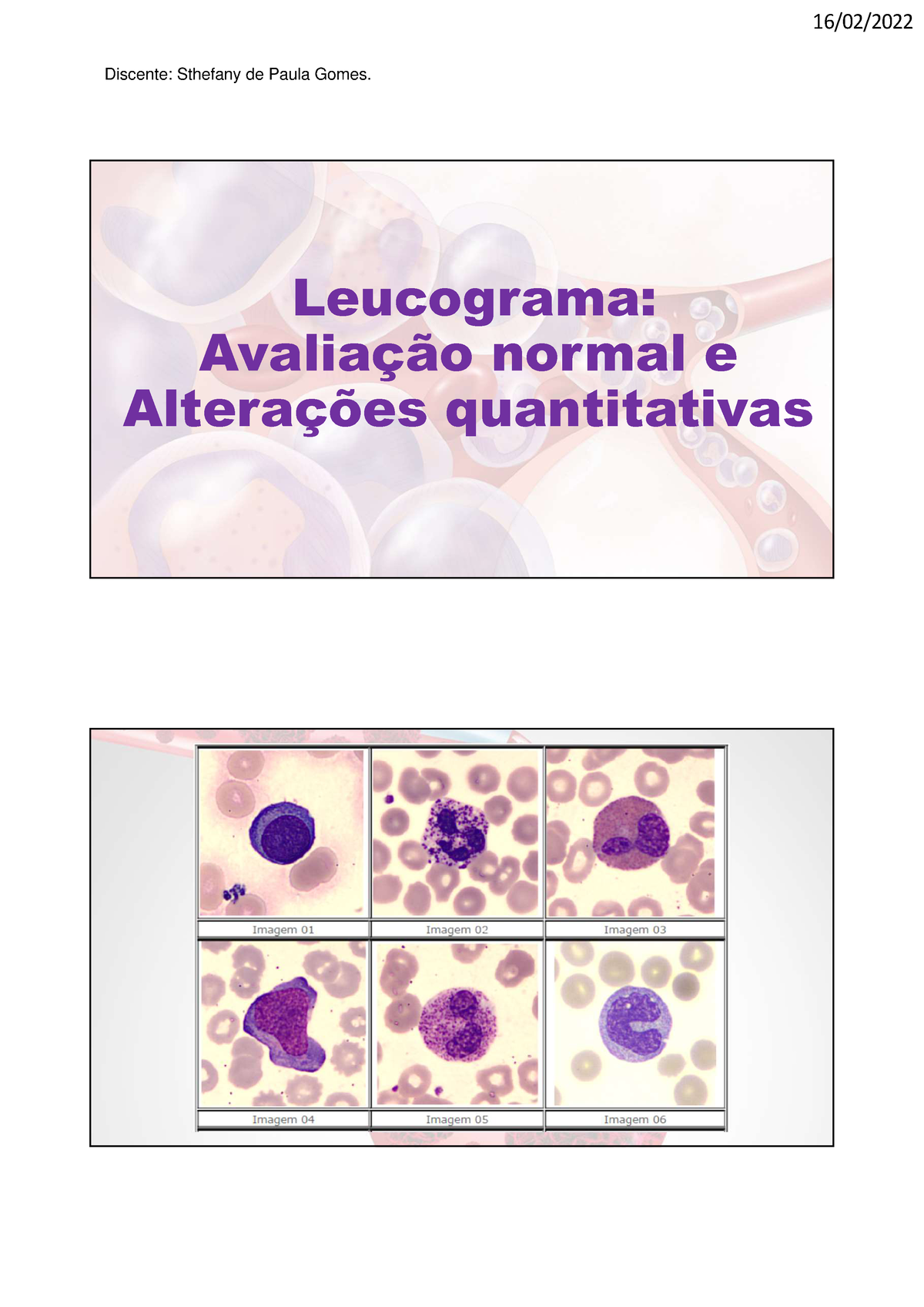 Exercicios leucograma Sthefany Gomes Leucograma Avaliação normal e