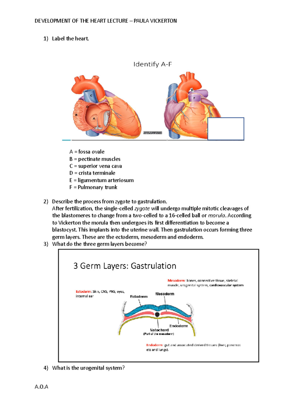 Development of the heart questions - Label the heart. A = fossa ovale B ...