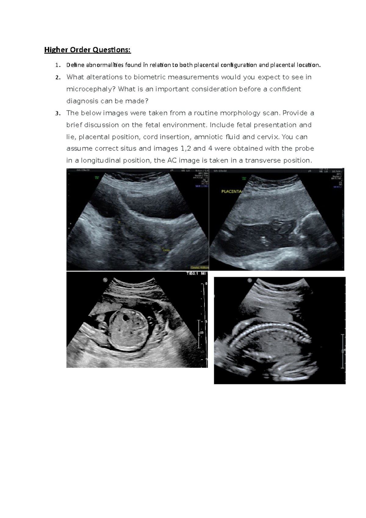 Higher Order Questionsenvironment,biometry, and heart Higher Order