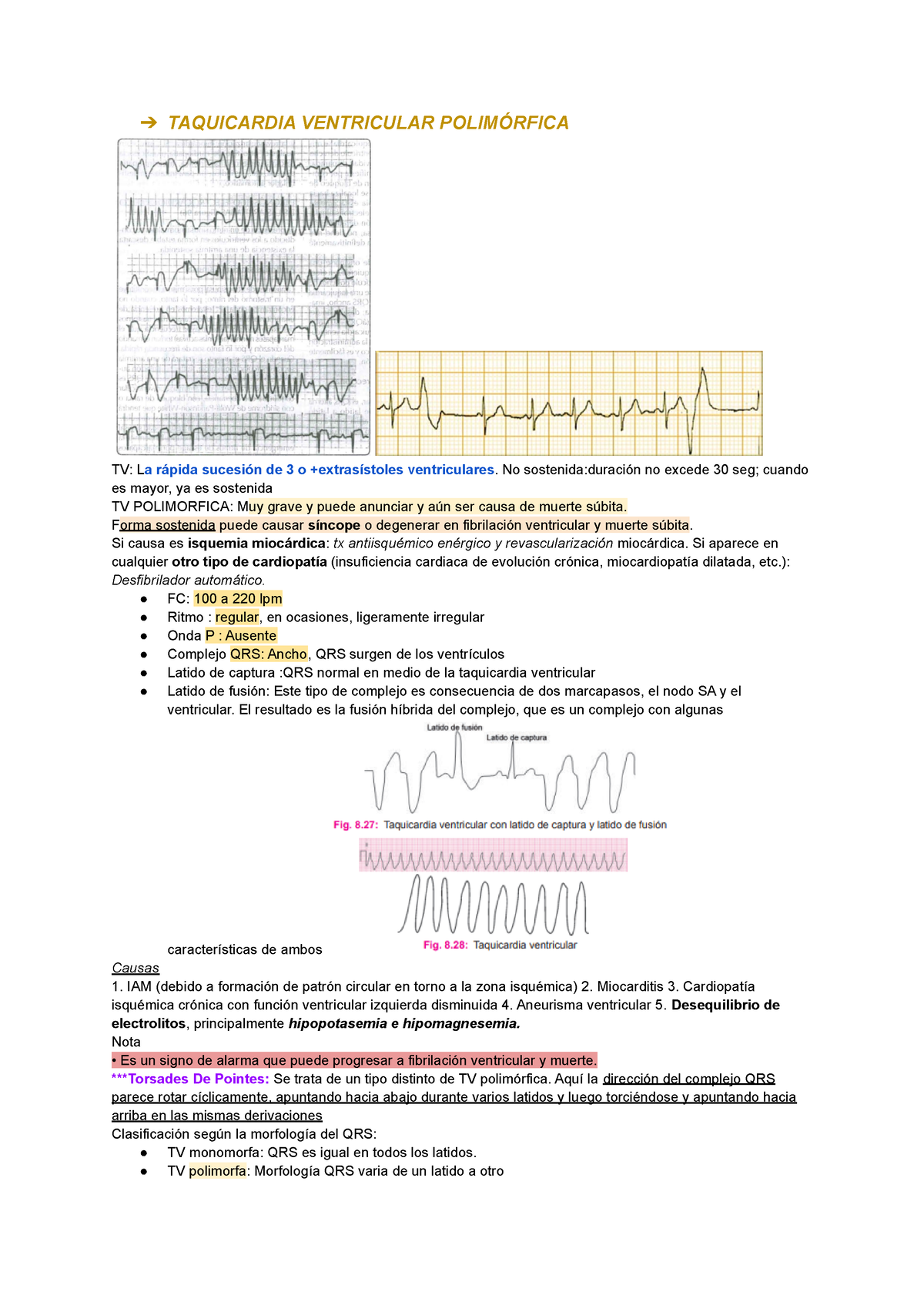 Taquicardias medicina deportiva TAQUICARDIA VENTRICULAR POLIMÓRFICA