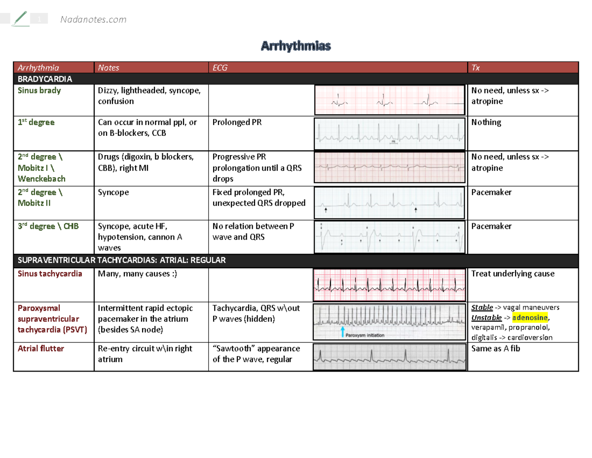 Arrhythmias - pharmacotheraby - Arrhythmia Notes ECG Tx BRADYCARDIA ...