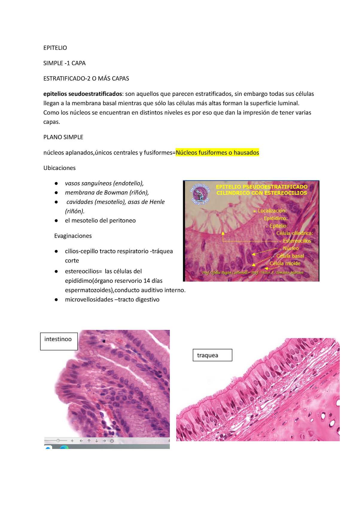 Identificar Tejidos EPITELIO SIMPLE CAPA ESTRATIFICADO O MÁS