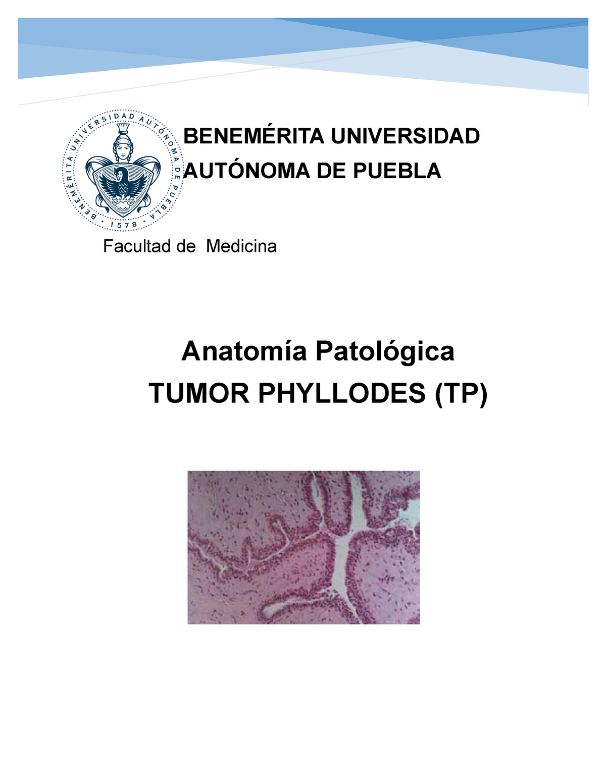 thesis on phyllodes tumor