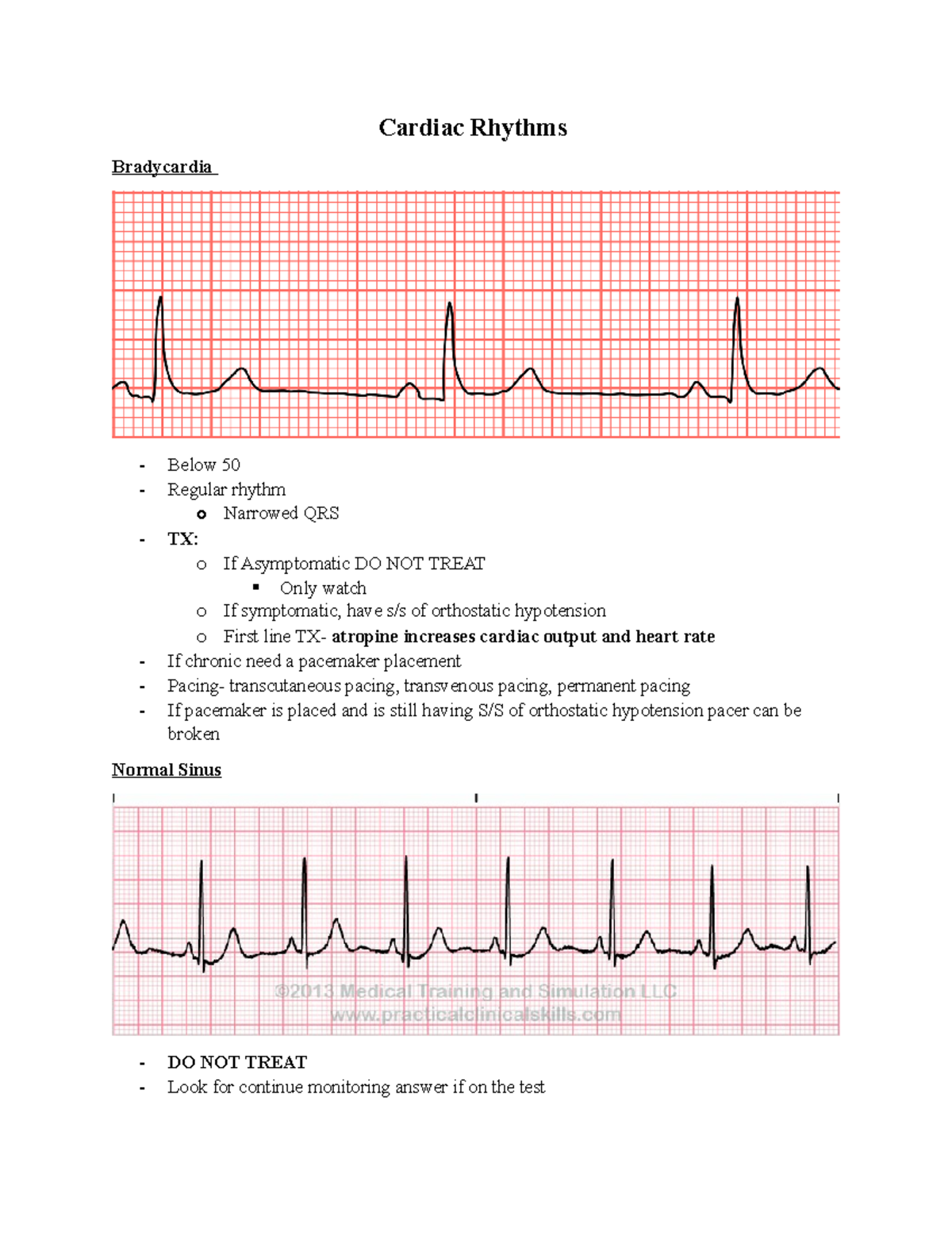 Cardiac Rhythms (video 17) - Cardiac Rhythms Bradycardia - Below 50 ...