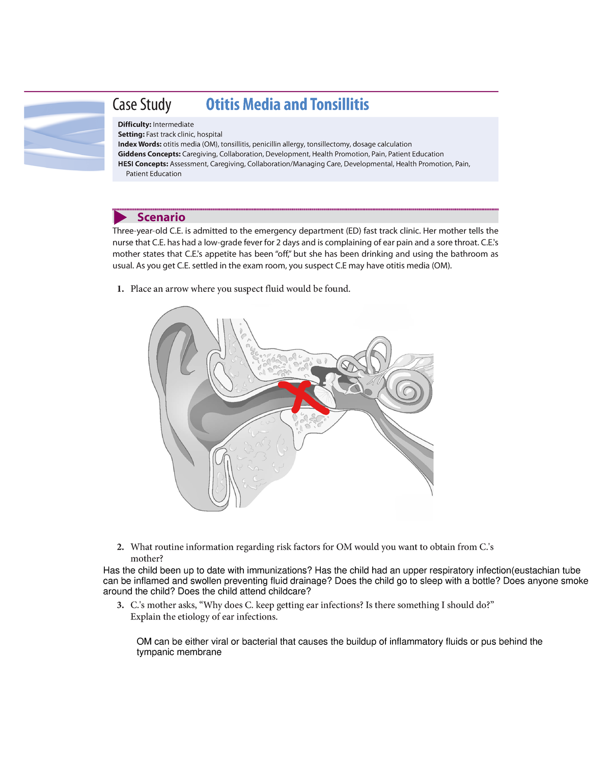 a case study on tonsillitis