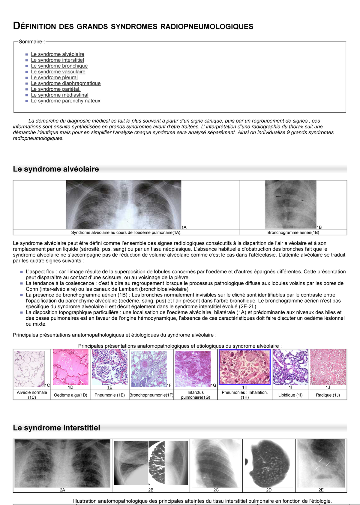 Les Différents Syndromes Radiologiques – NKSQU