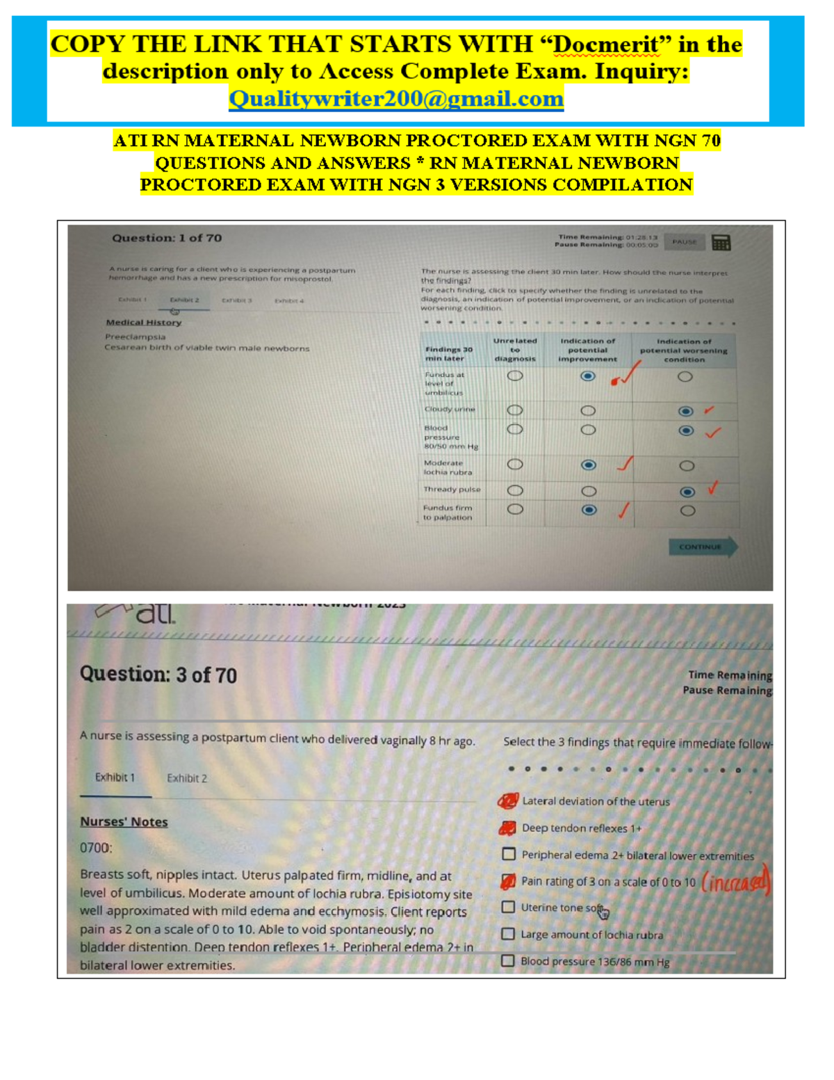 ALL 2024 ATI RN Maternal Newborn Proctored Exam with NGN 2023 All 70