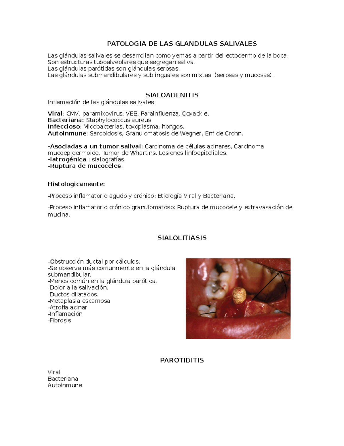 Patología De Glándulas Salivales - PATOLOGIA DE LAS GLANDULAS SALIVALES ...