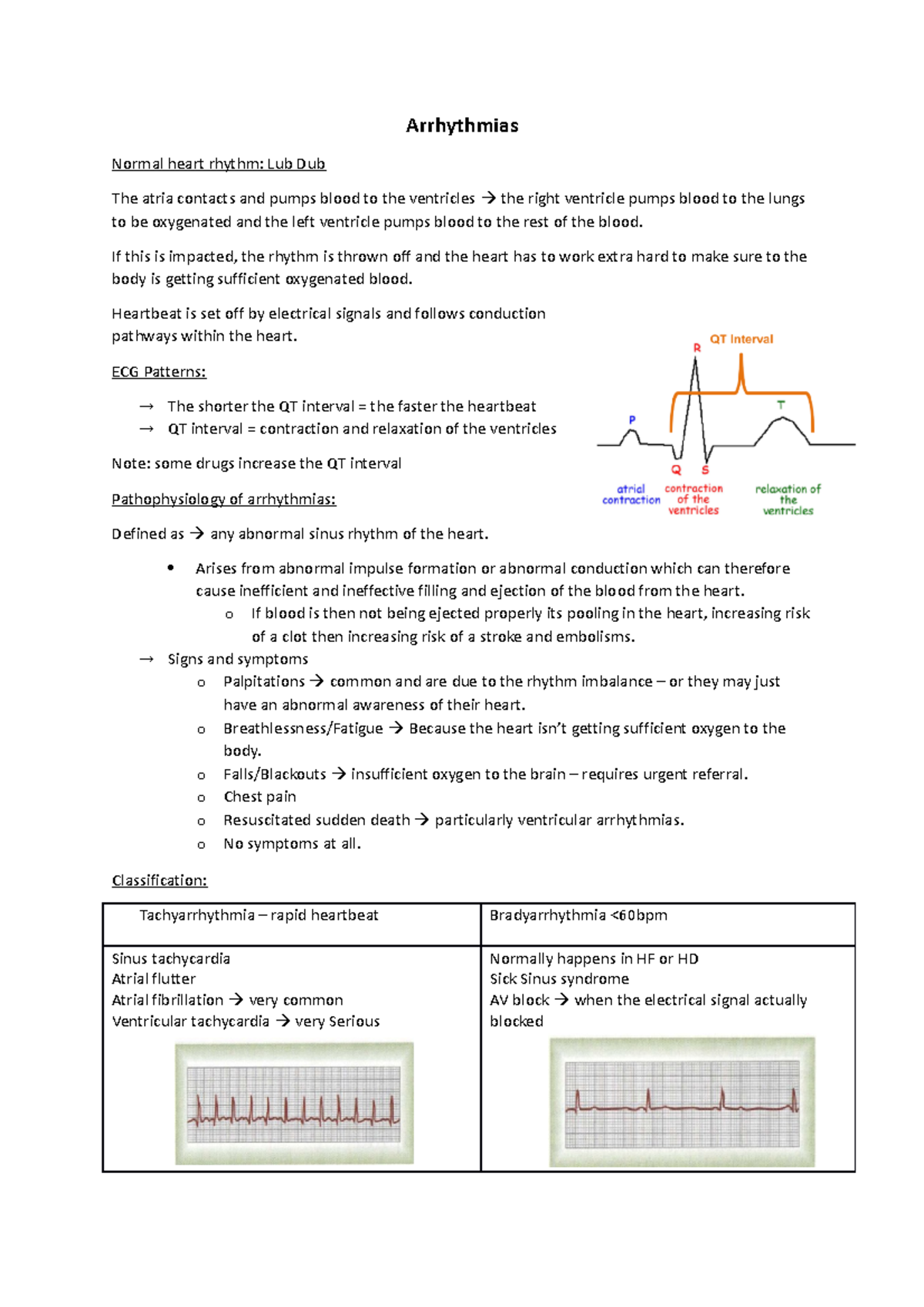 Arrhythmias - Lecture Notes - CSB601 - QUT - Studocu