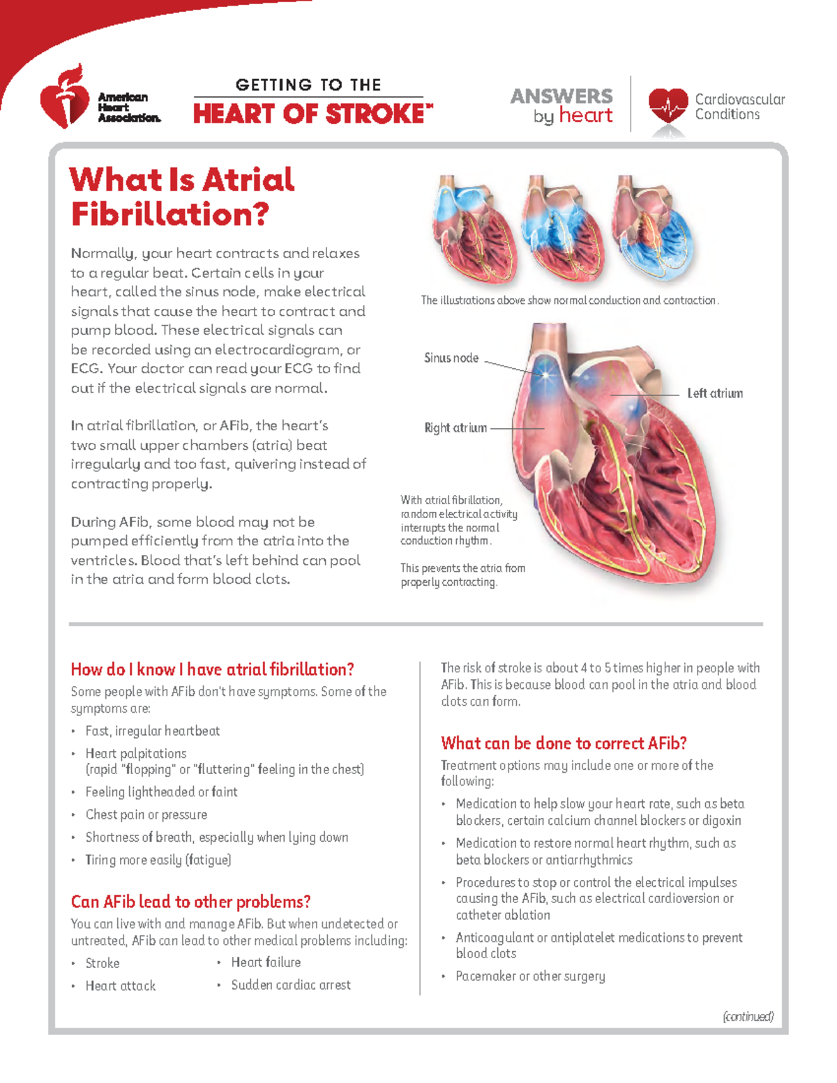 What is atrial fibrillation - With atrial fibrillation, random ...