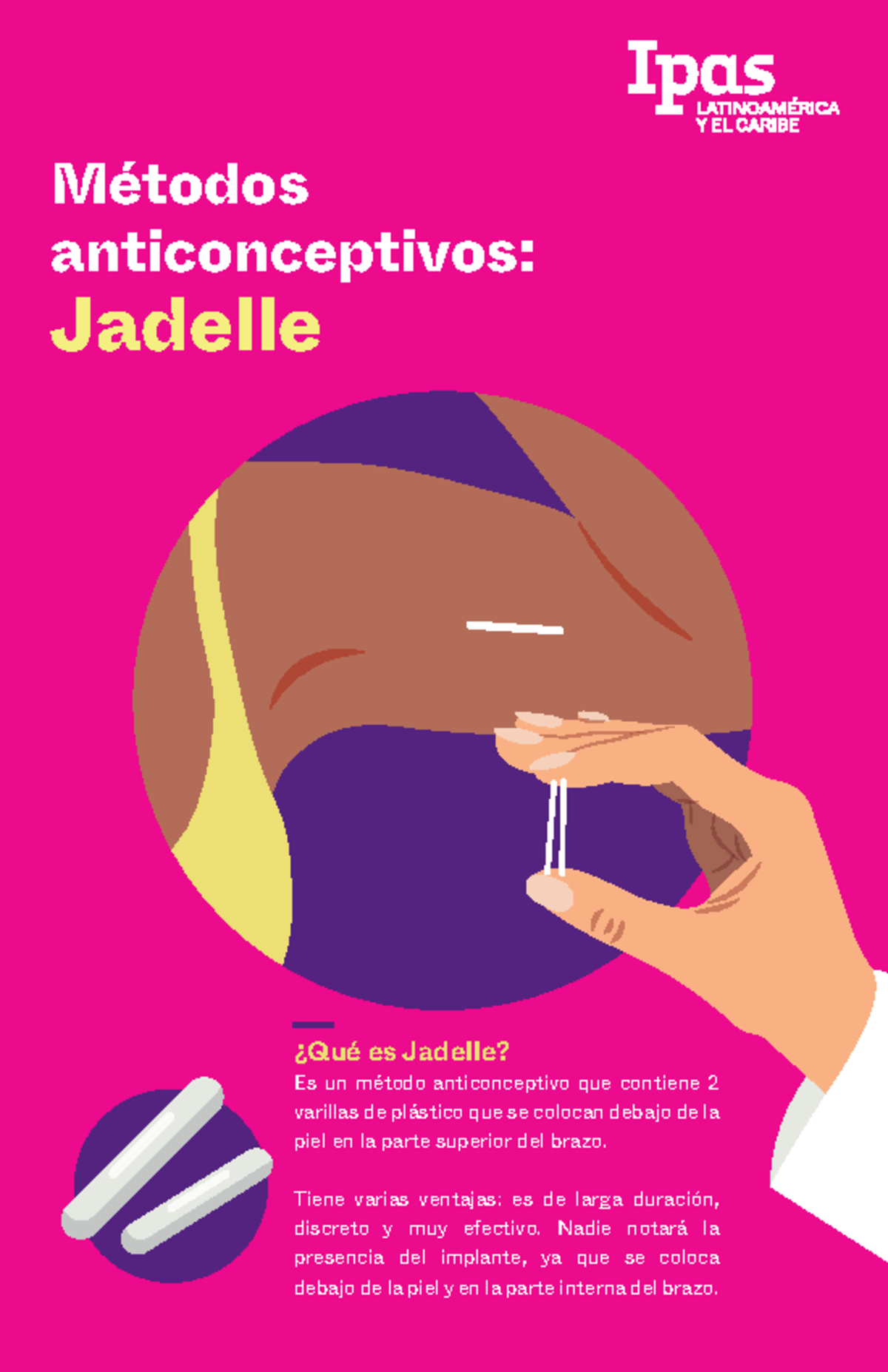 metodos-anticonceptivos-m-todos-anticonceptivos-jadelle-qu-es