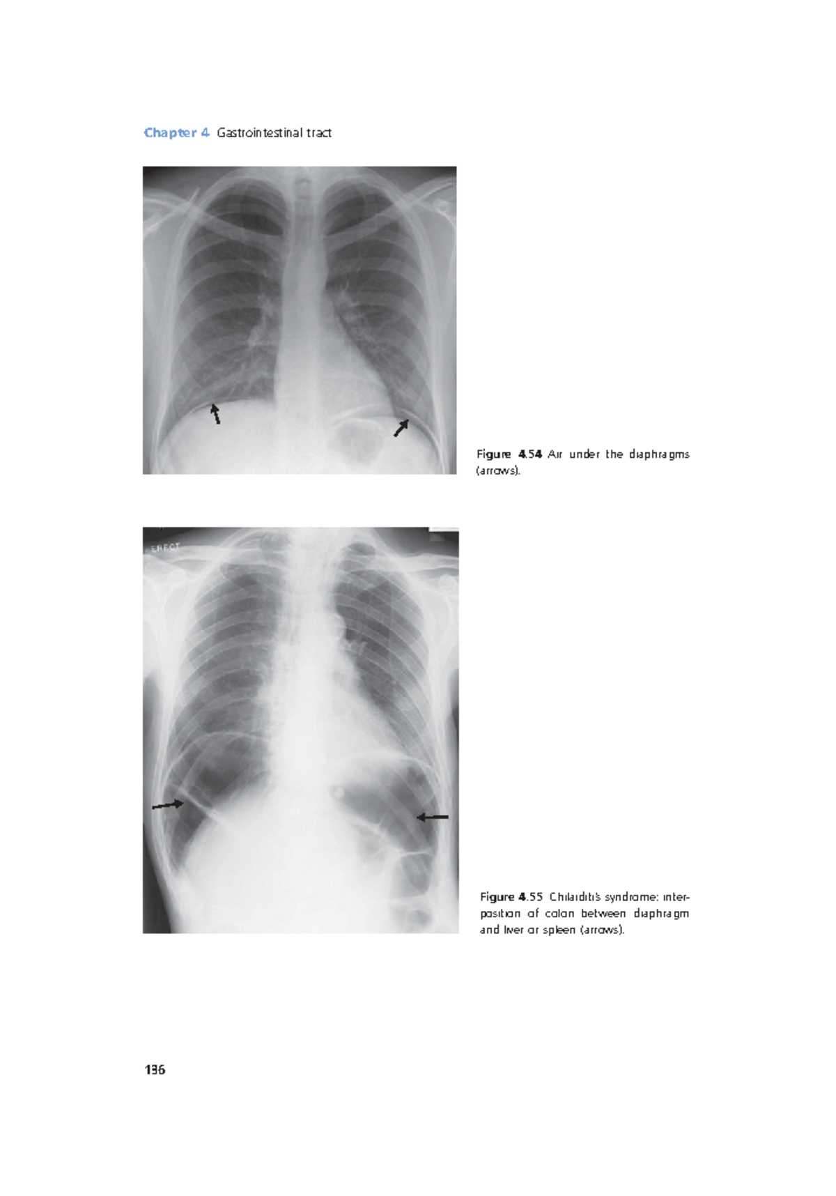 Radiology Lecture Notes pdf (46) - Chapter 4 Gastrointestinal tract 136 ...