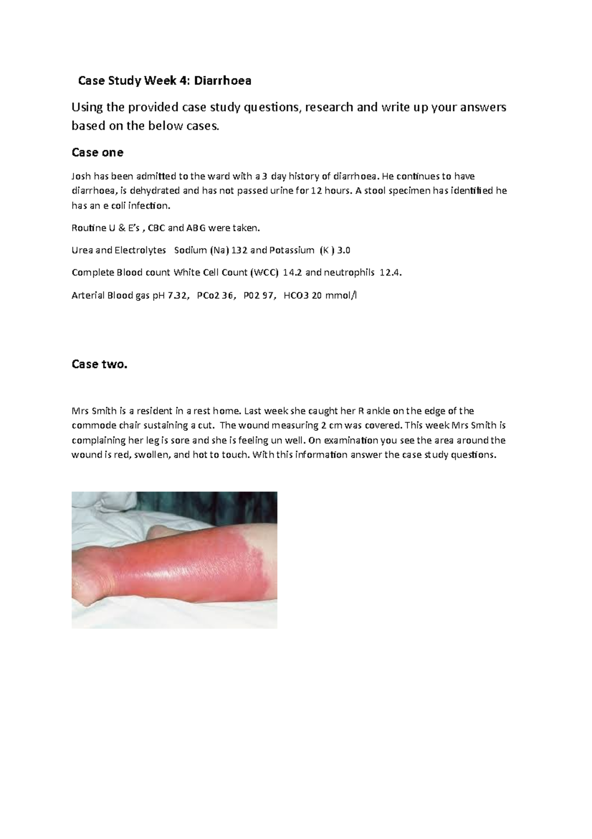 Case Study Scenarios- pathophysiology - Case Study Week 4: Diarrhoea ...