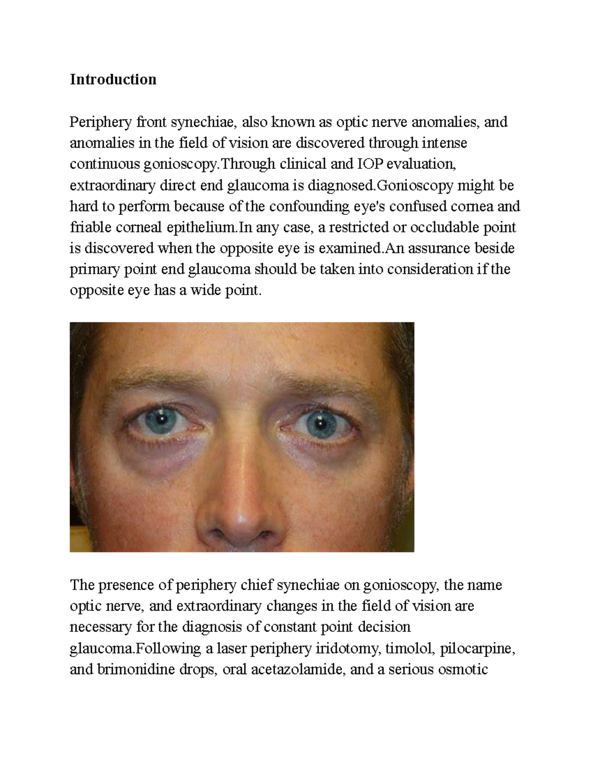 Summary of Anisocoria A detailed discussion about the etiology