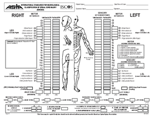 Edema y diencefalo - neuro - Resumen Detallado: Síndrome Diencefálico ...