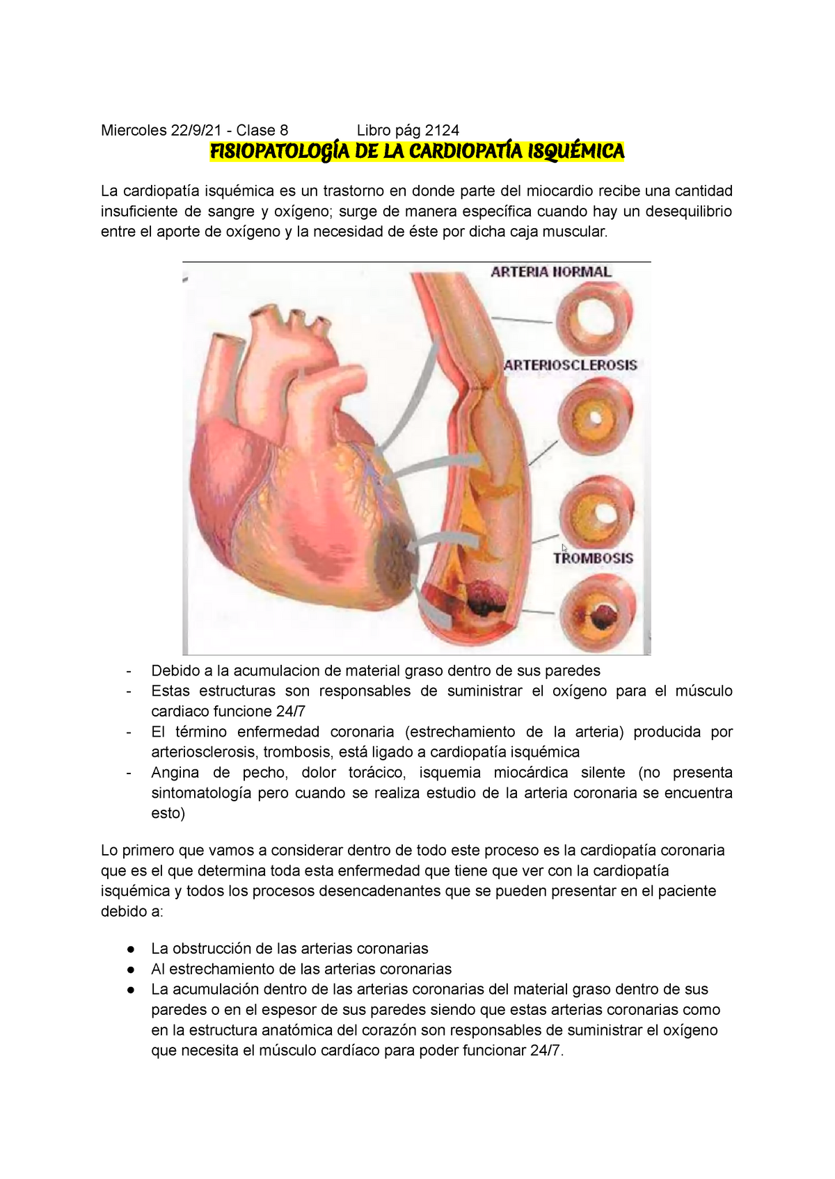 Cardiopatia Isquemica Miercoles Clase Libro P G Fisiopatolog A De La