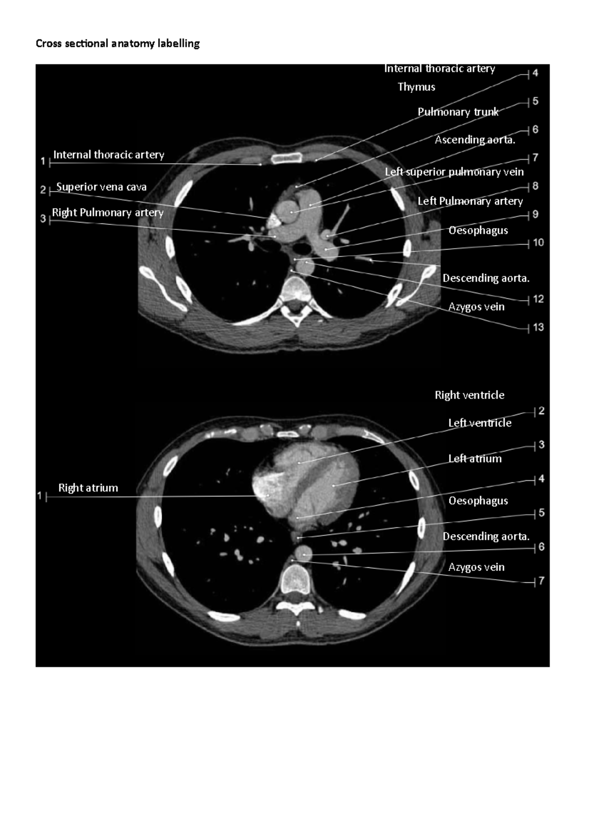 Cross sectional anatomy labelling practice Cross sectional anatomy