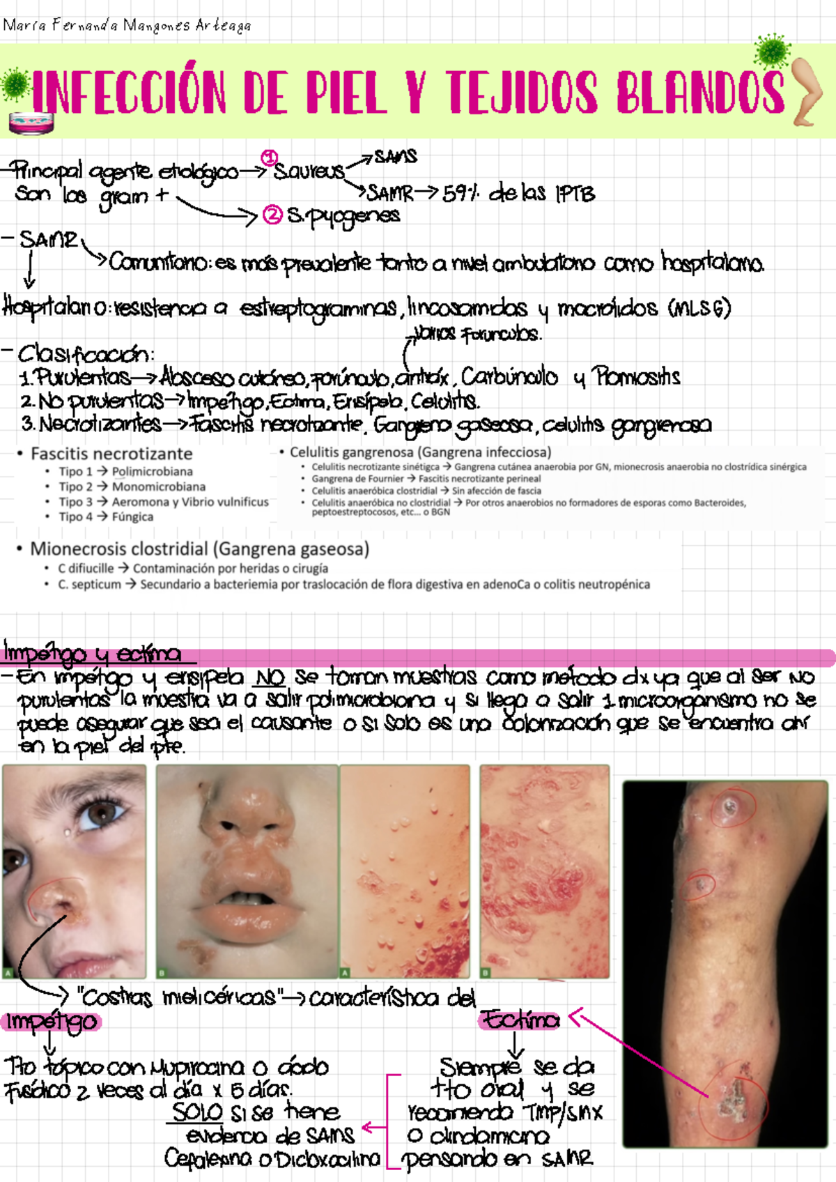 IPTB 🦵🏼🧫 (resumen Video) - Infección de piel y tejidos blandos ...