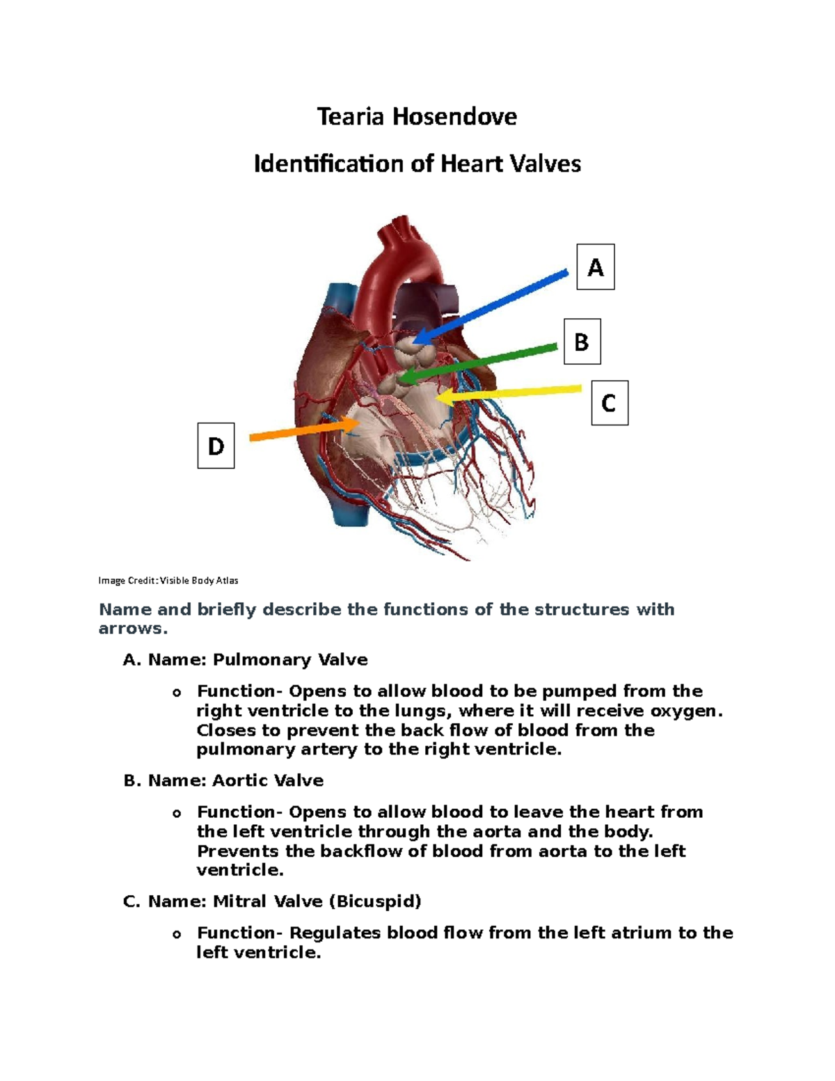 Heart valves2 none Tearia Hosendove Identification of Heart Valves Image Credit Visible